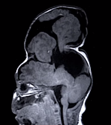 A brain unlike no other. (Credit: Boston Children’s Hospital)